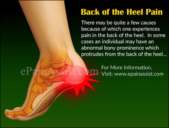 lower back heel pain