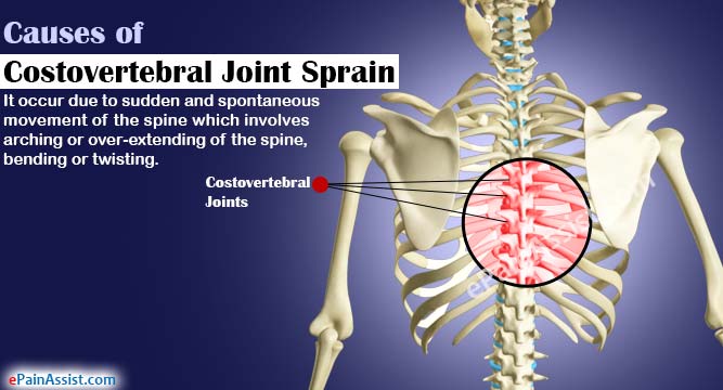 Costovertebral Joint Injection