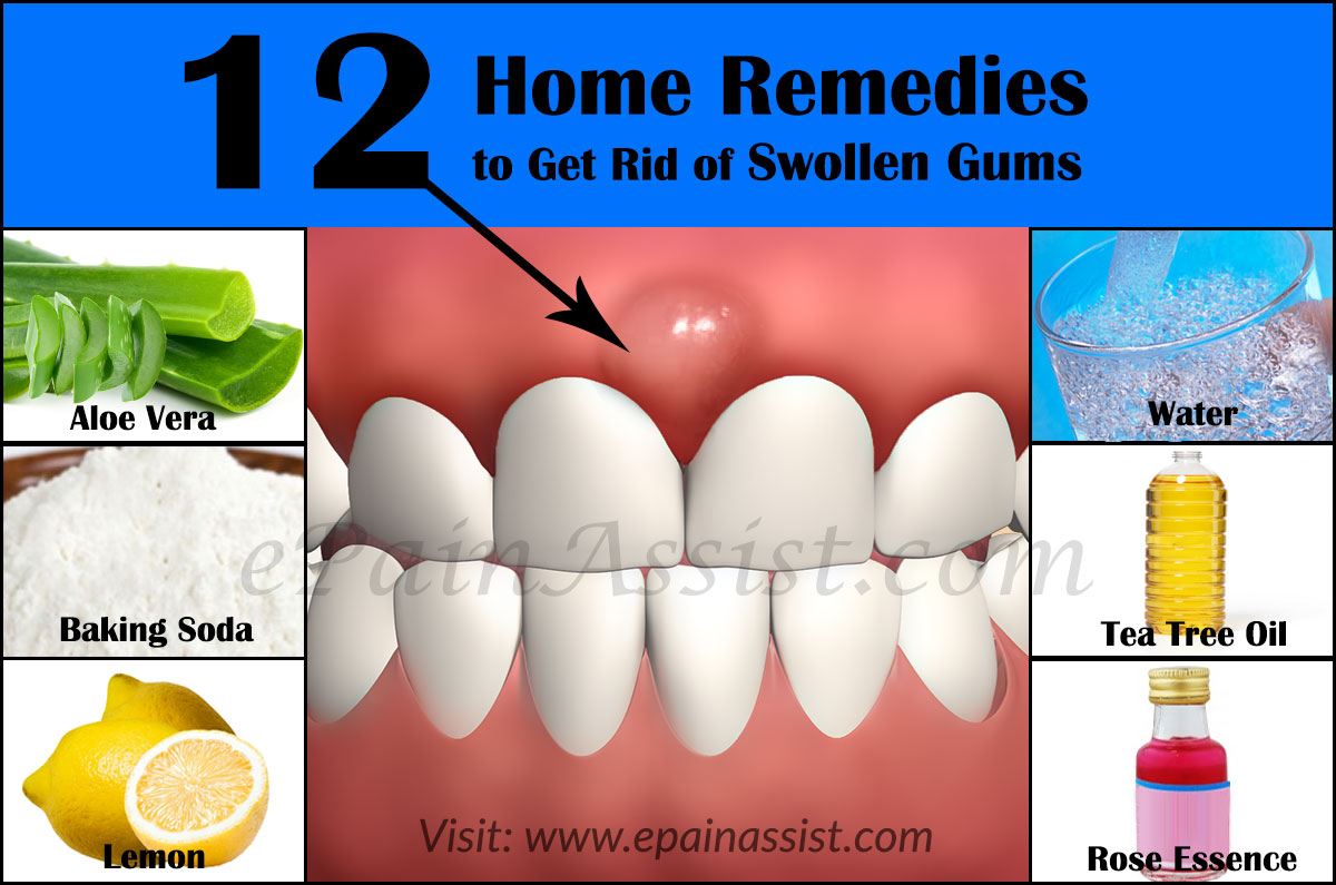 gums swollen rid remedies causes remedy swelling treatment mouth infection does water face below virus effective because pregnancy should during
