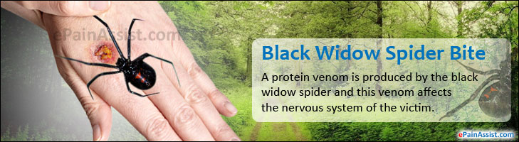 Black Widow Spider Bite|Signs|Symptoms|Treatment-Hot Bath, Ibuprofen