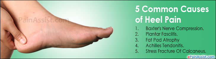 5 Major Causes of Heel Pain