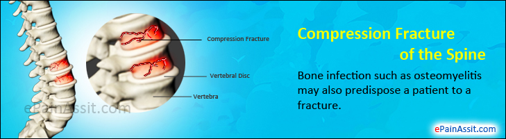 compression fracture treatment nj