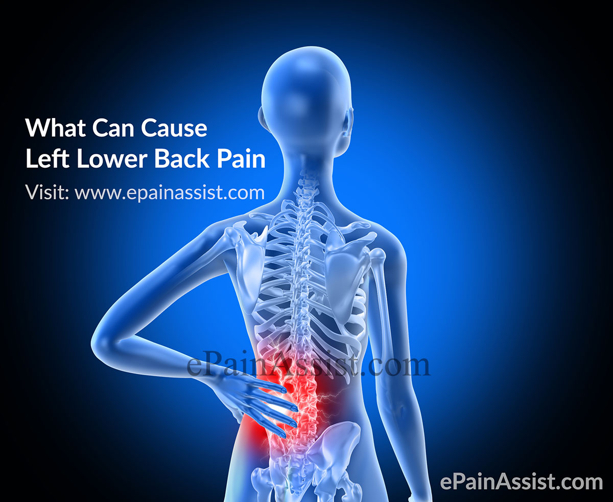 What causes lower back pain on left side?