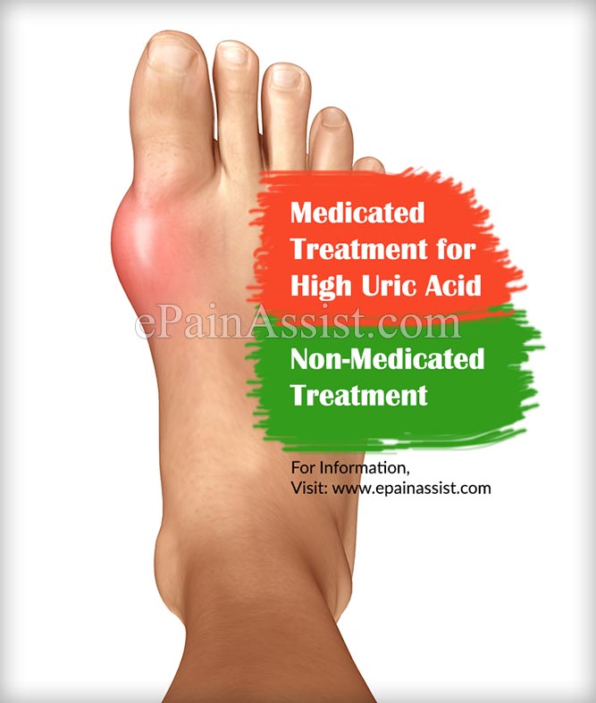 Medicated & Non-Medicated Treatments for High Uric Acid