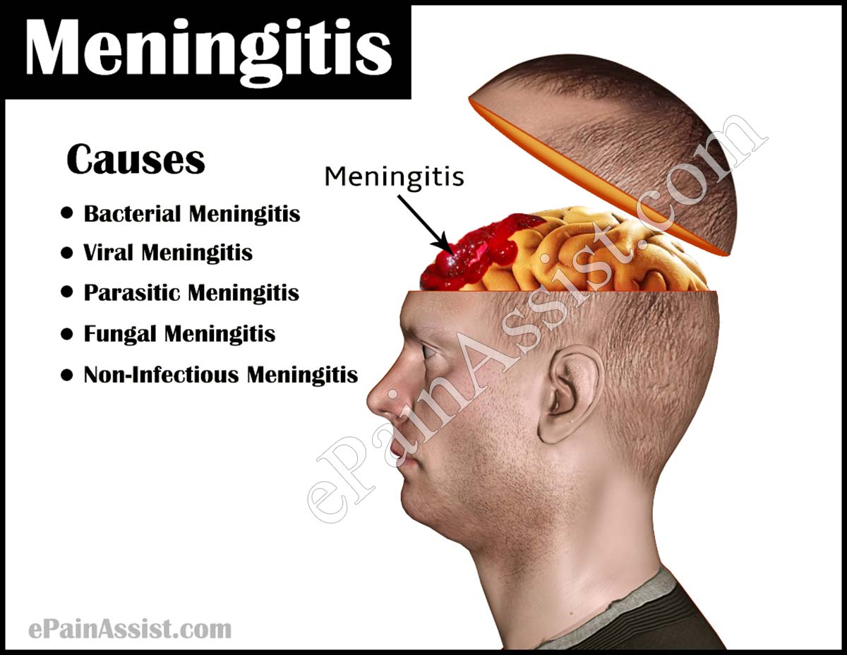 meningitis lp findings