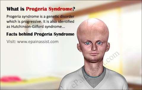 progeria syndrome symptoms causes expectancy genetic facts signs hutchinson disorders gilford disorder newborn growth suffer birth children genetics slow hair