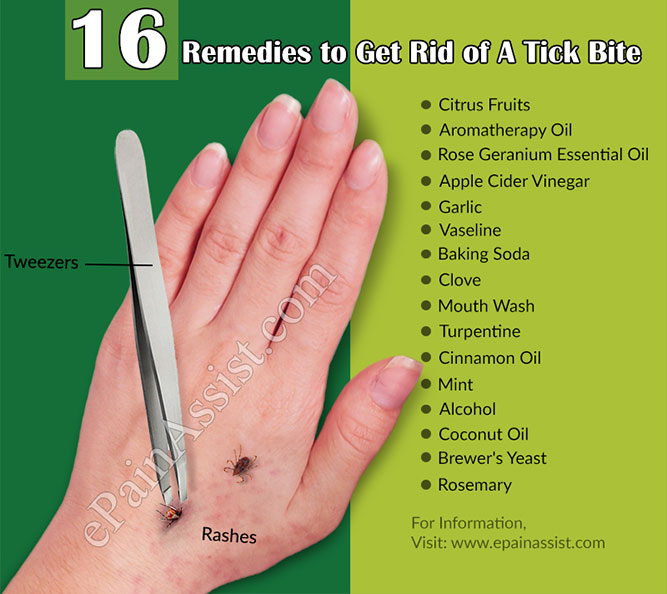 How To Treat And Prevent Tick Bites On Dogs Top 10 Home Remedies ...