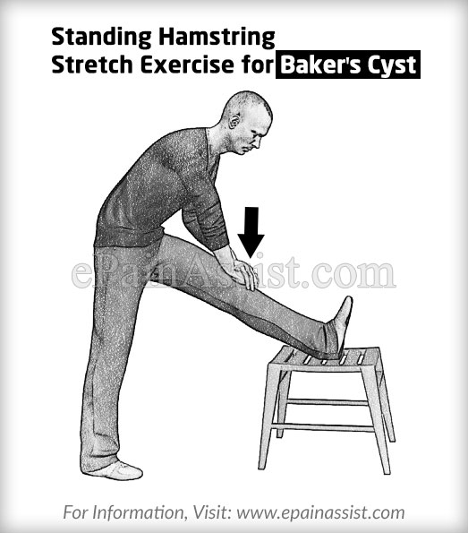Knee Stretches Bakers Cyst Or Popliteal Cyst