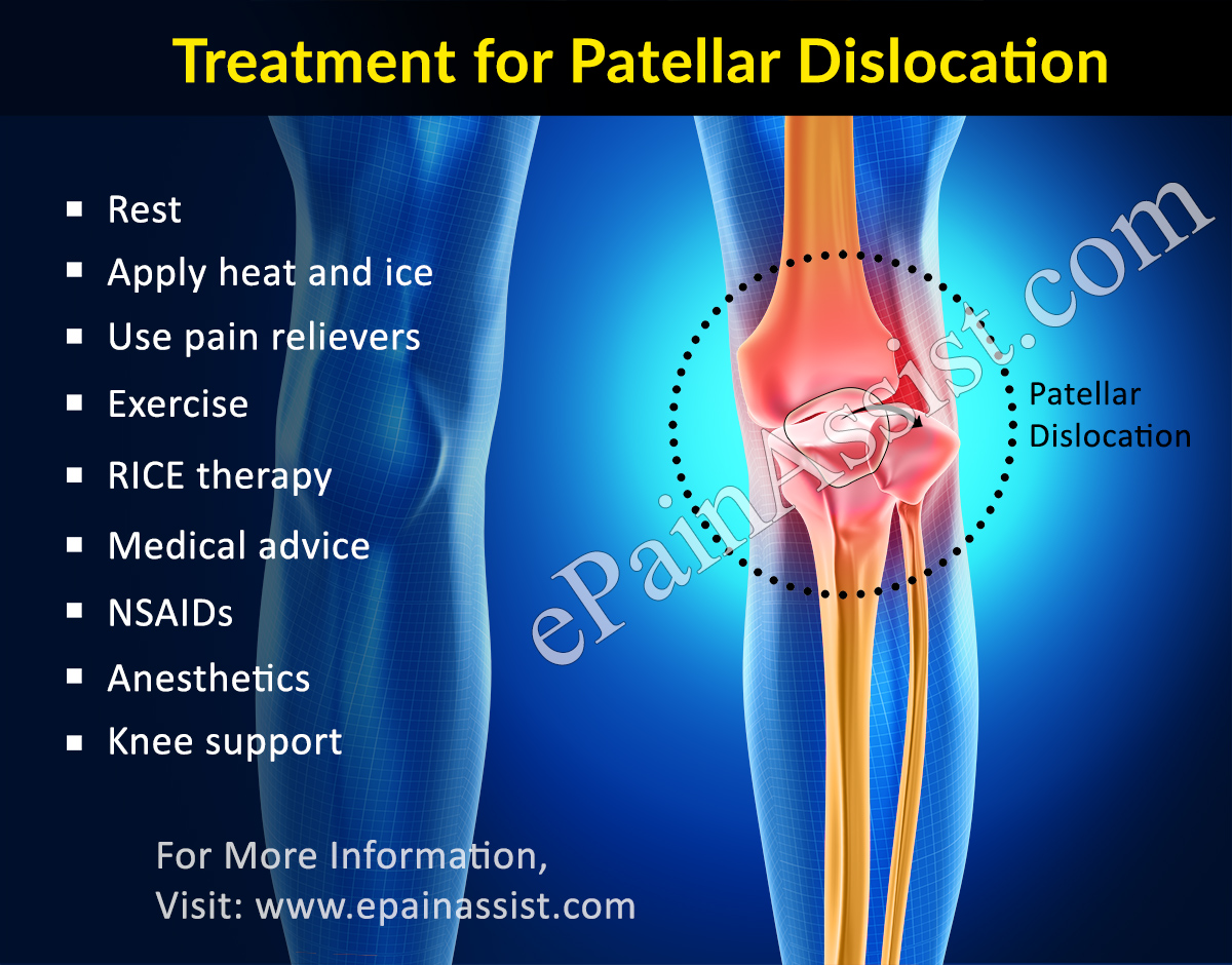 patellar dislocation rehab