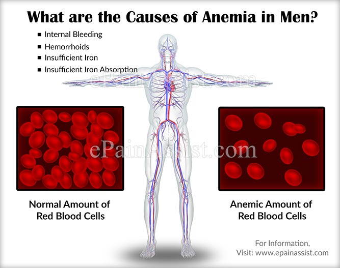 Causes Of Anemia In Men Know Its Types Symptoms Treatment
