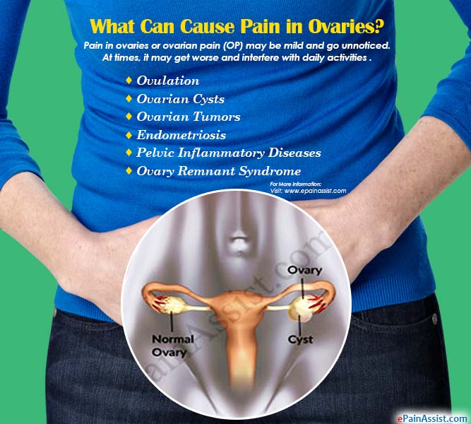 What Can Cause Pain In Ovaries And How Is It Treated
