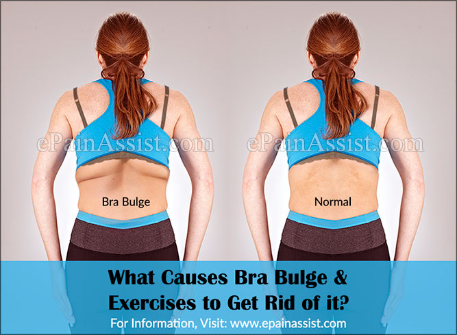 What Causes Bra Bulge & Exercises to Get Rid of it?