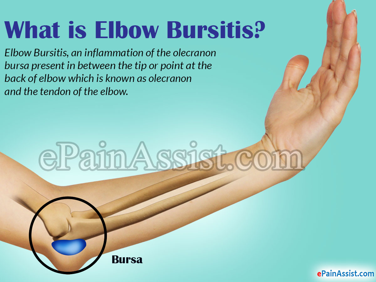 Elbow Bursitis Anatomy