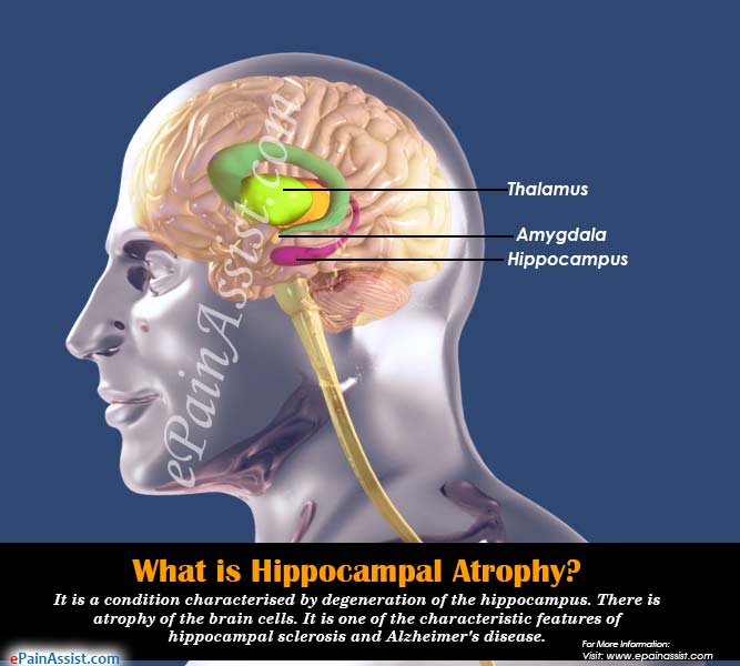 What is Hippocampal Atrophy?
