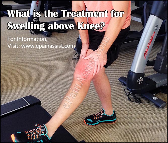 What Can Cause Swelling Above Knee And What Is Its Treatment