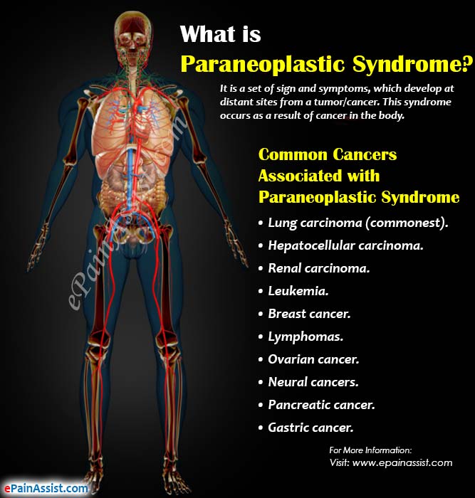 What is Paraneoplastic Syndrome?