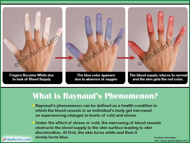 Raynauds Phenomenontypessymptomscausestreatmentprognosis