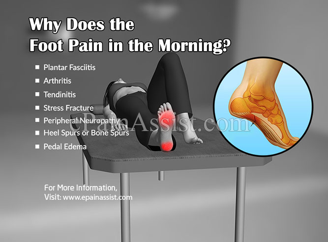 Why Does The Foot Pain In The Morning